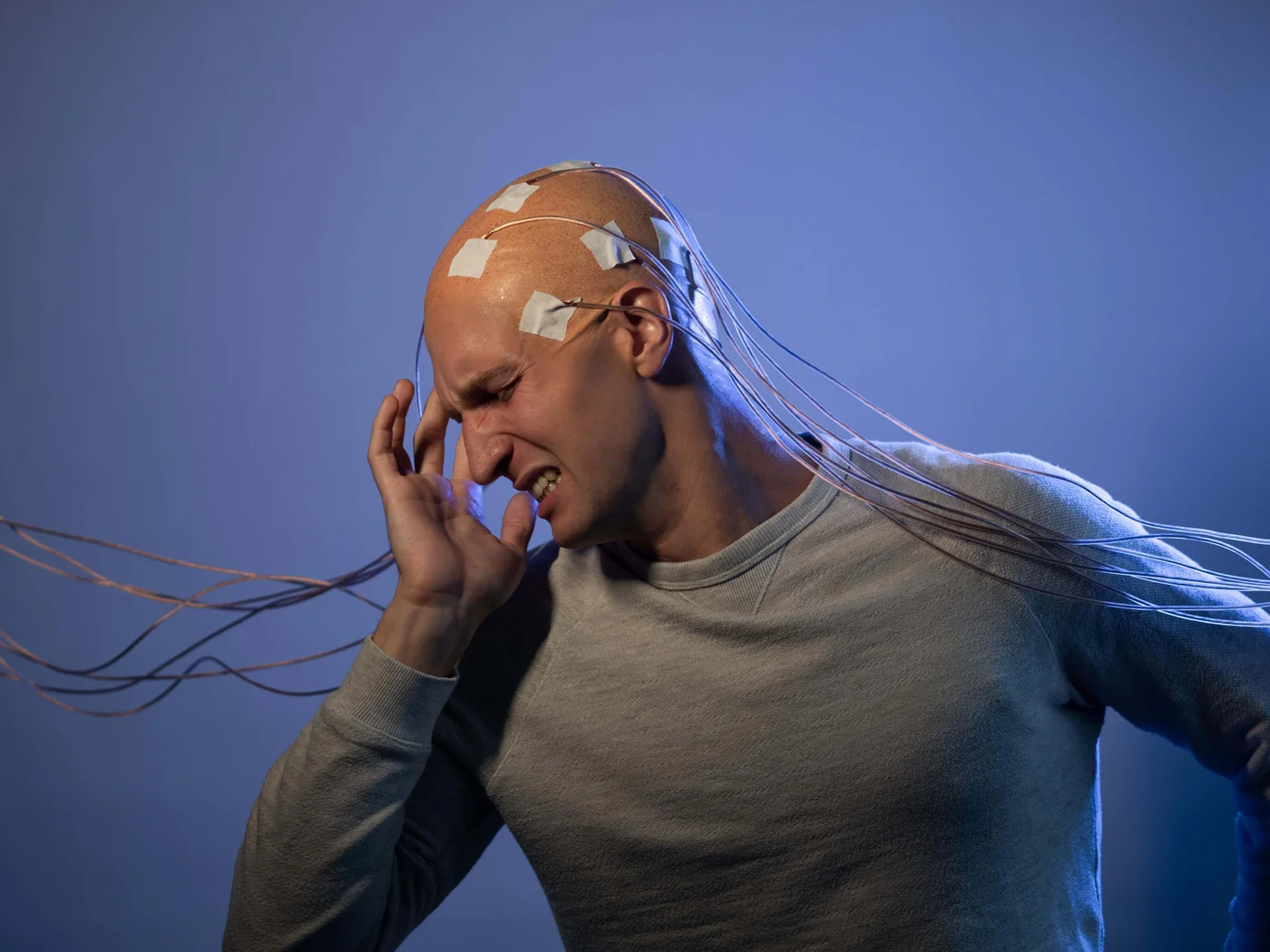 Epilepsi (Sara Hastalığı) Nedir?